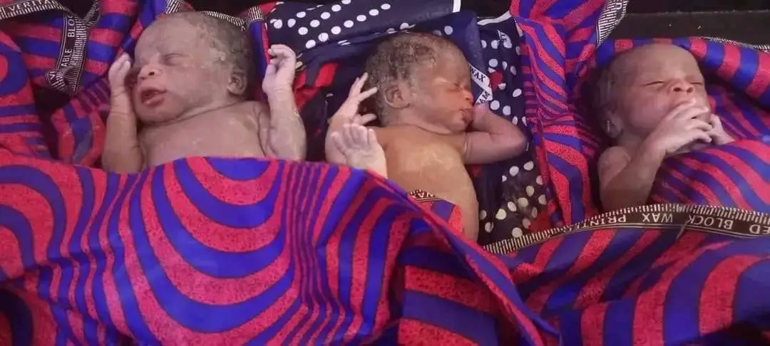 Tchad : une femme donne naissance à des triplés à Mongo