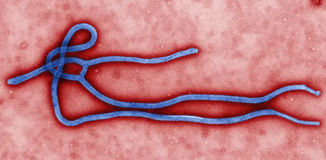Ebola en visite officielle aux Etats Unis d'Amérique