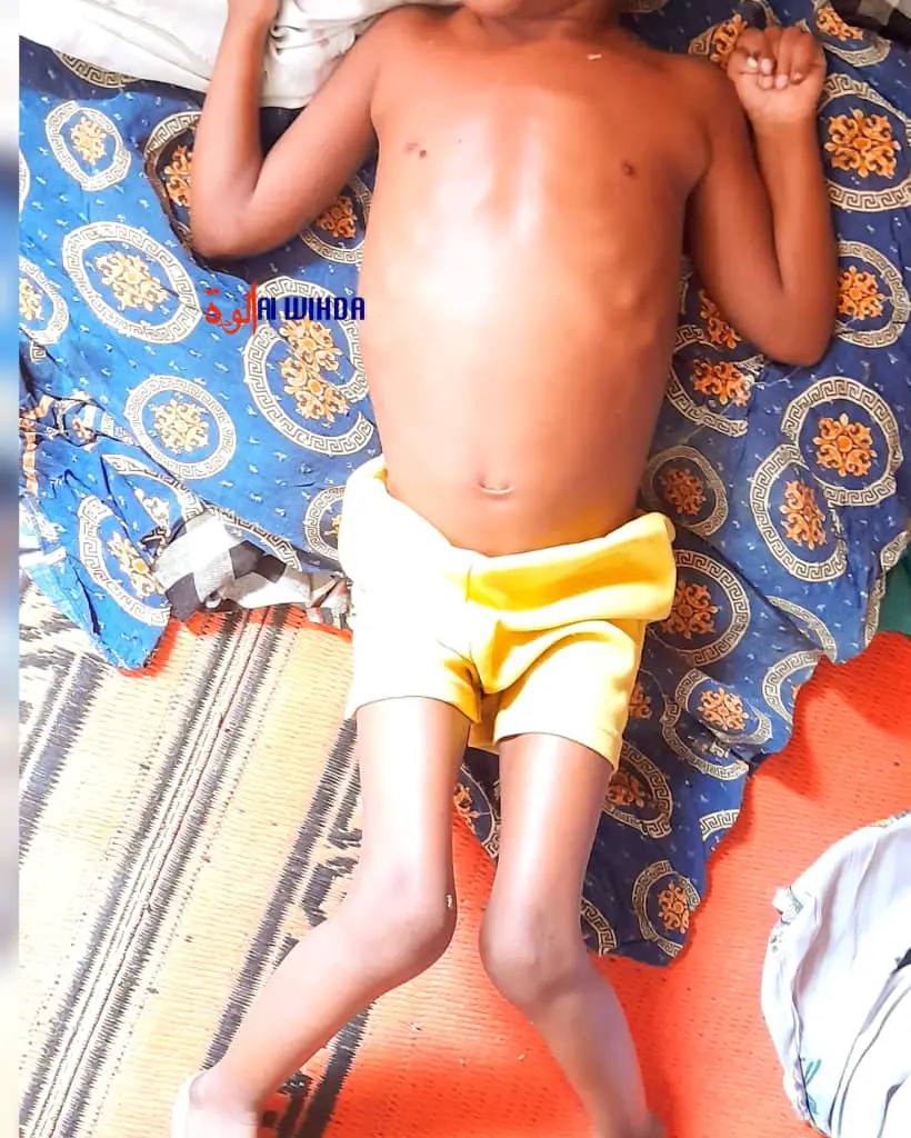 Tchad : un appel à l'aide pour Brahim Moussa, un enfant paralysé de 6 ans