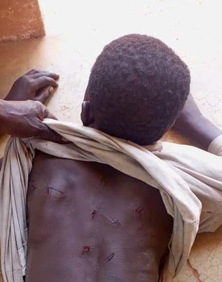 Tchad : violemment tabassé par sa mère, il se réfugie au commissariat
