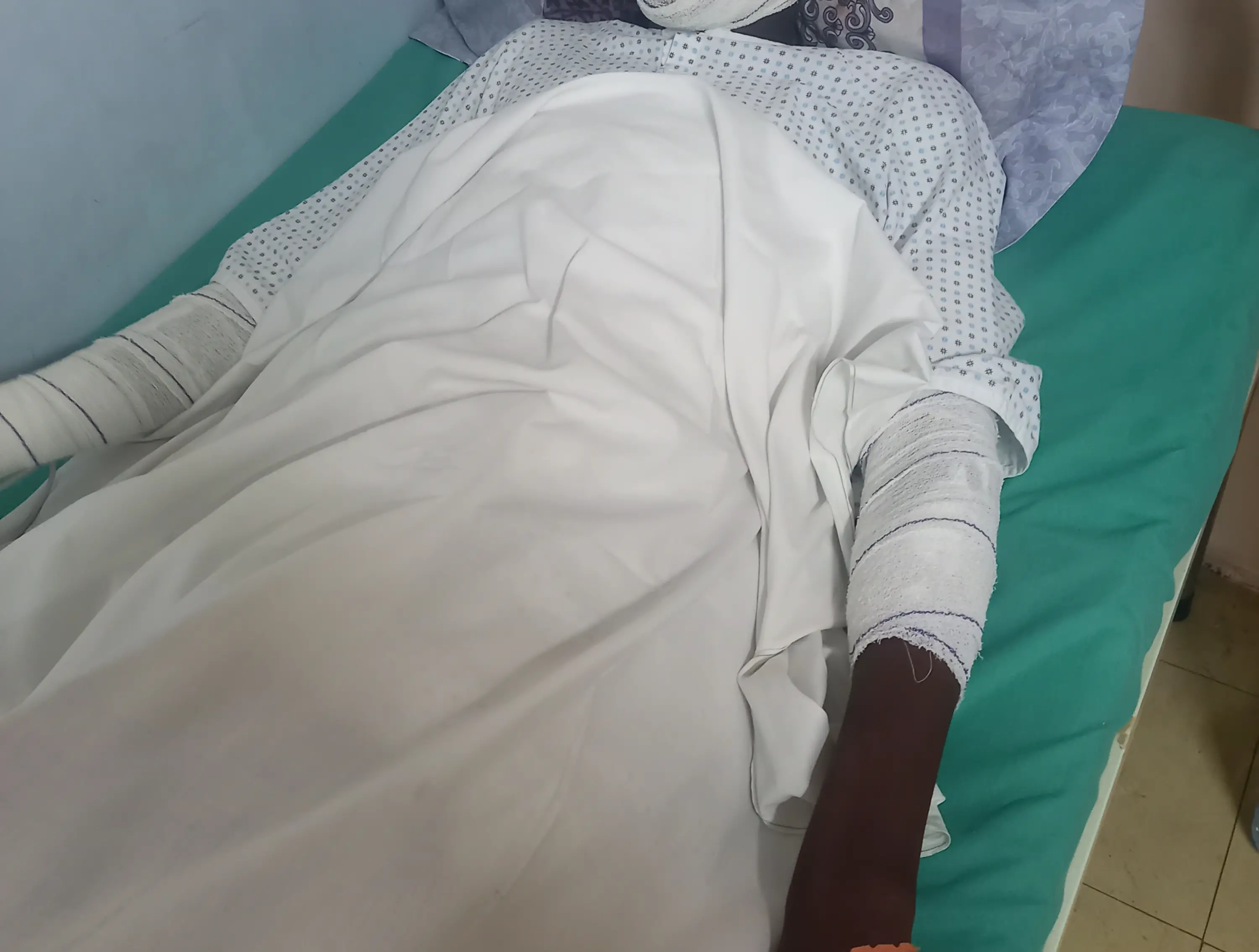Cameroun : un étudiant tchadien grièvement blessé dans un incendie électrique à Douala