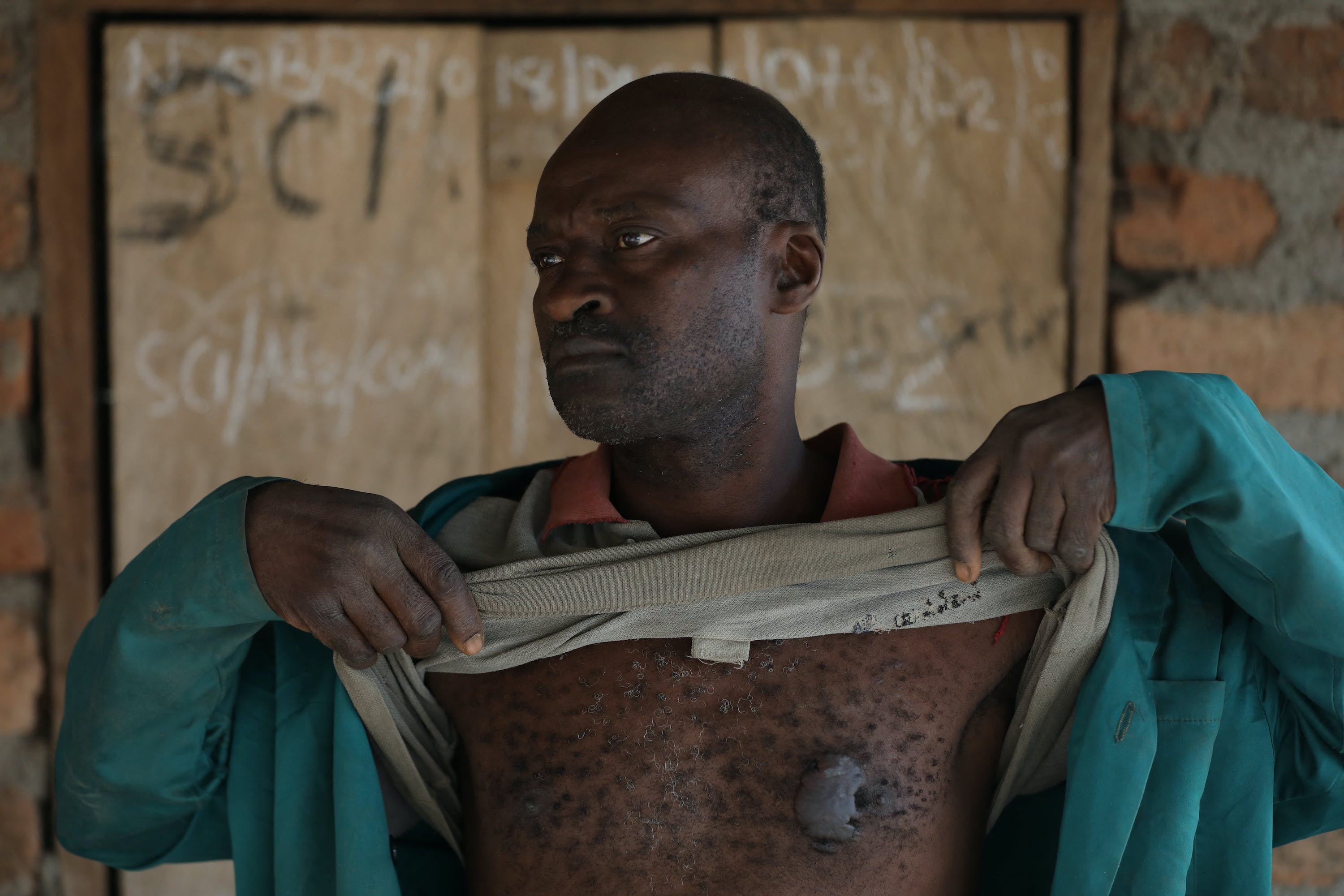 Cameroun : des atrocités récurrentes dans les régions anglophones, selon Amnesty qui exige des enquêtes. © Amnesty Cameroun : des atrocités récurrentes dans les régions anglophones, selon Amnesty qui exige des enquêtes. © Amnesty