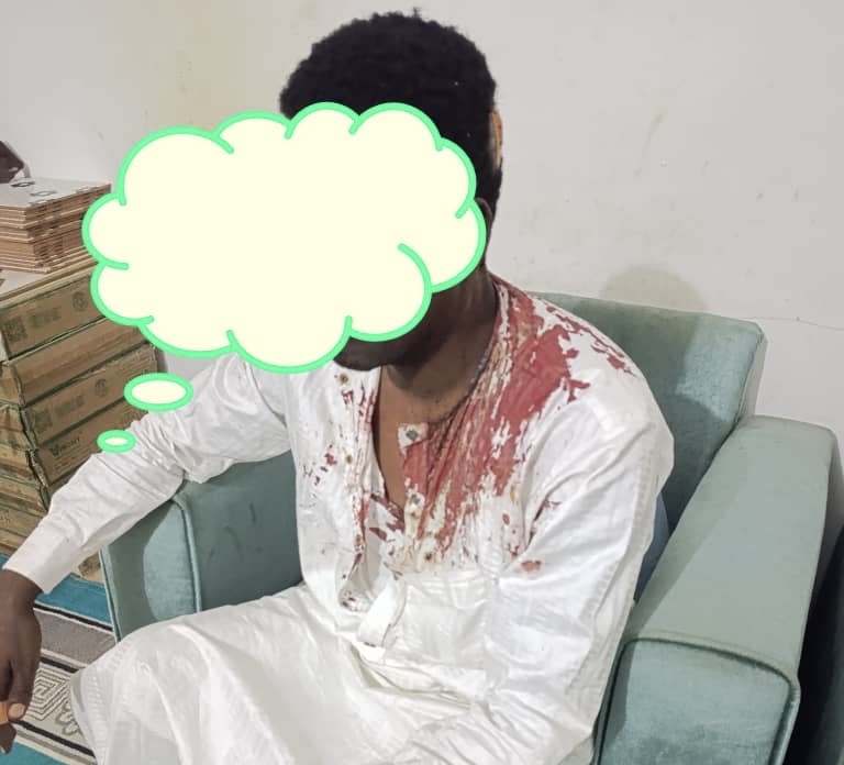 Tchad : Le ministre de la Communication apporte son soutien au journaliste Ahmat Bichara, victime d’une tentative d’assassinat