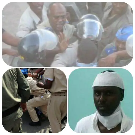 DJIBOUTI - Députés et leaders de l'opposition, tabassés : Sombre Journée Mondiale des Droits de l'Homme pour les djiboutiens