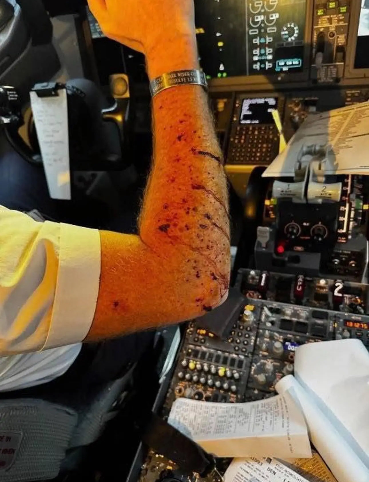USA : Pare-brise de 737 MAX fissuré à 36 000 pieds, pilote blessé