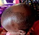 Tchad : une fillette de deux ans mordue par une hyène à Dagour dans le Salamat