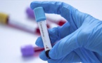 Covid-19 : 7 nouveaux cas au Cameroun, les règles d'hygiène "non respectées"