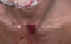 Tchad : le fils d'un préfet tente de tirer sur un chat et atteint un homme à la gorge