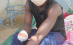 Tchad : il sauve des enfants et perd sa main dans l'explosion d'une grenade, Augustin appelle à l'aide