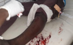 Tchad : ingénieur blessé par balle, l'Ordre des architectes s'exprime