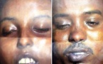 Djibouti : Les autorités lancent un appel à témoin et diffusent les photos des kamikazes
