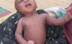 Tchad : victime d'une malformation congénitale, un bébé est né sans pieds au Sila