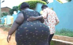 Tchad : obsession pour la forme « apoutchou » chez la femme, un danger pour la santé
