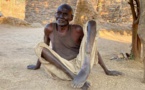 Tchad : un homme âgé de 80 ans lance un appel à l'aide pour des soins médicaux