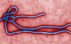 Ebola en visite officielle aux Etats Unis d'Amérique