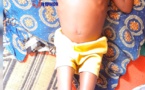 Tchad : un appel à l'aide pour Brahim Moussa, un enfant paralysé de 6 ans