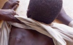 Tchad : violemment tabassé par sa mère, il se réfugie au commissariat