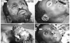Djibouti: Le massacre méconnu d'Arhiba, un crime de guerre demeuré impuni.