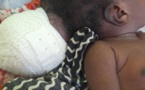 Tchad : une fillette atteinte d'une maladie grave a besoin d'une intervention chirurgicale urgente