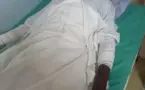 Cameroun : un étudiant tchadien grièvement blessé dans un incendie électrique à Douala