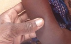 Tchad : une fille torturée après le vol d’une tasse de graines de Néré