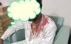 Tchad : Le journaliste Ahmed Bachara, collaborateur de l'ATPE, échappe à une tentative de tir