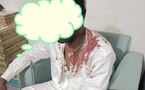 Tchad : Le ministre de la Communication apporte son soutien au journaliste Ahmat Bichara, victime d’une tentative d’assassinat