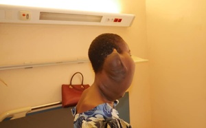 Tchad : une fillette atteinte d’une masse au cou admise au CHU La Renaissance
