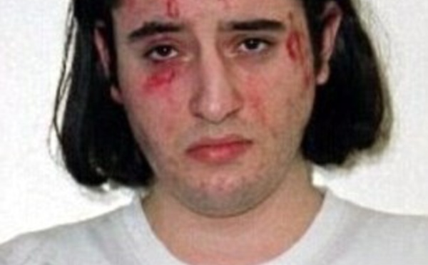 Un marocain victime de graves tortures en Grande Bretagne ?