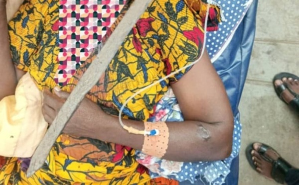 Tchad : une femme grièvement blessée lors d’une violence conjugale à Sarh