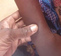 Tchad : une fille torturée après le vol d’une tasse de graines de Néré