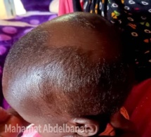 Tchad : une fillette de deux ans mordue par une hyène à Dagour dans le Salamat