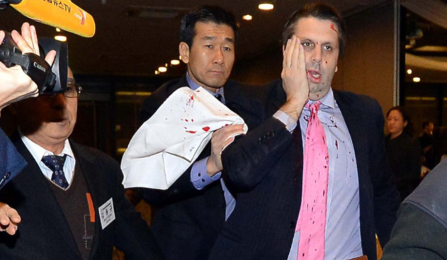 L’ambassadeur américain à Séoul, victime d’une attaque à arme blanche L’ambassadeur américain à Séoul, victime d’une attaque à arme blanche